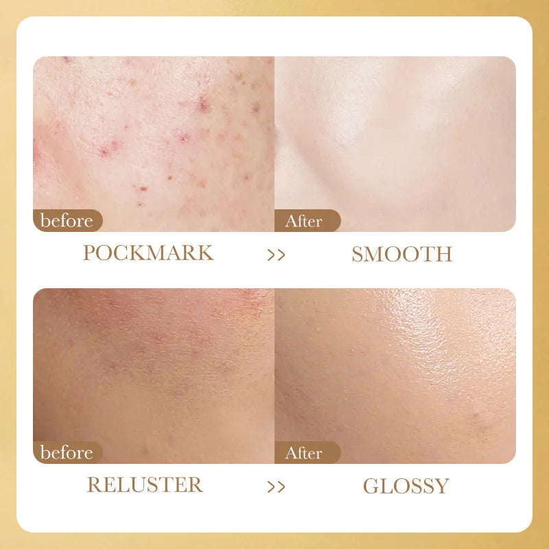 Face Serum Niacinamide Whitening Freeze-Dried Powder